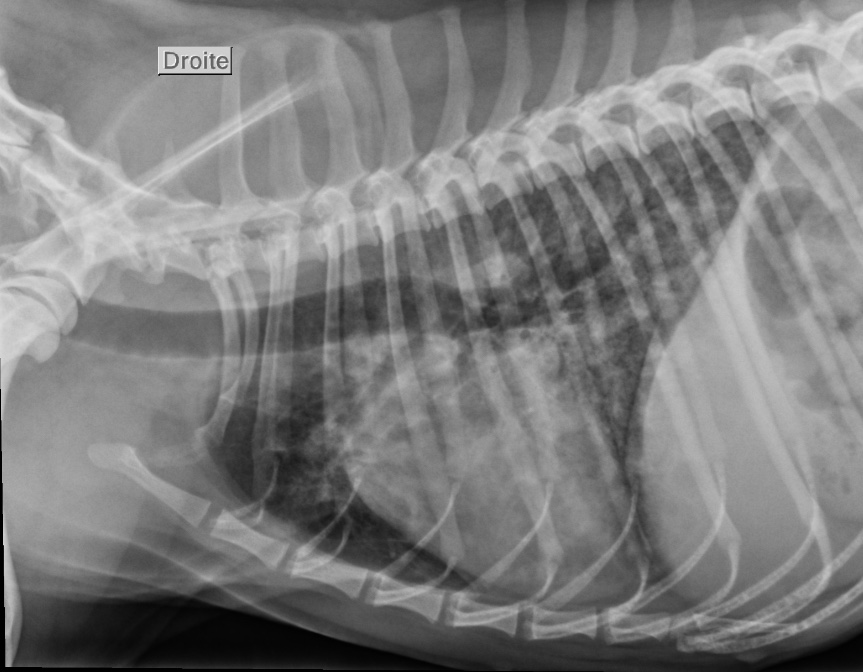 Photo 1 ,a Radiographie thoracique (profil droit).
